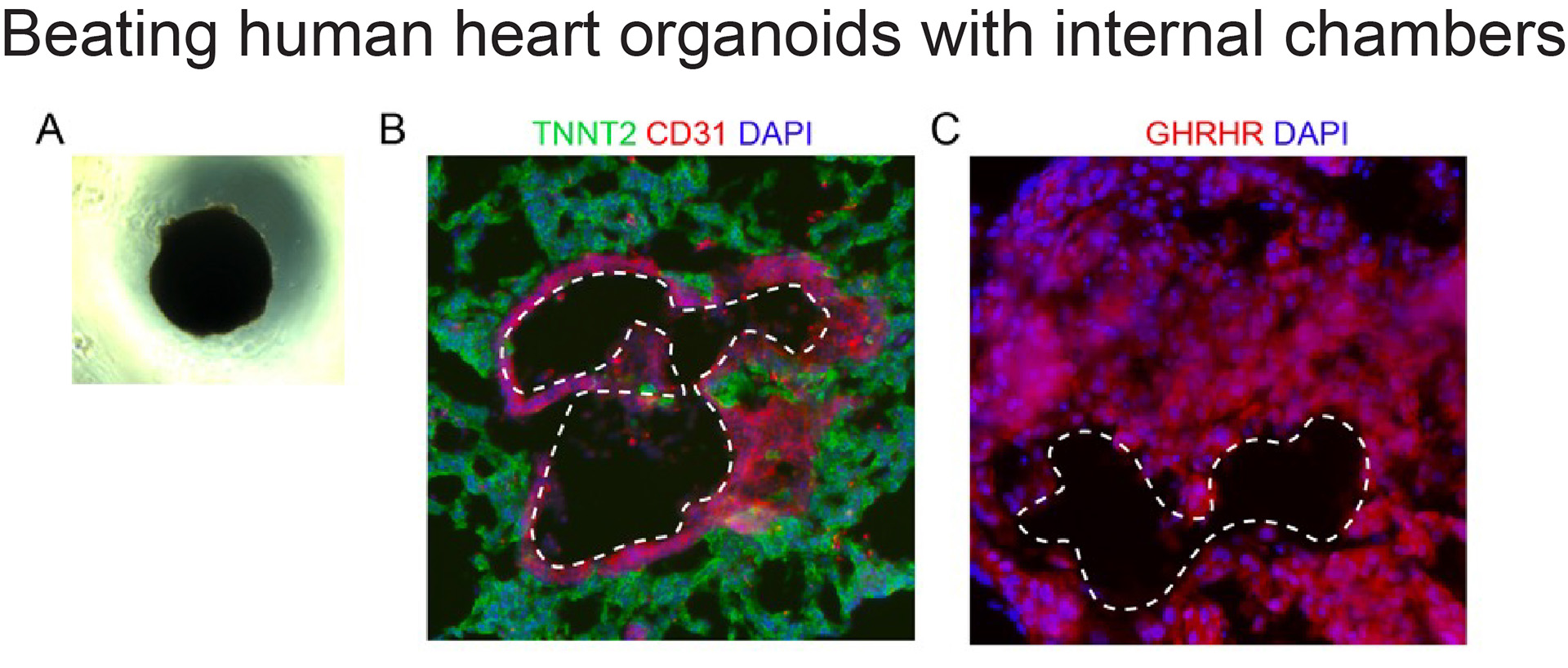 Beating human heart organoids with internal chambers