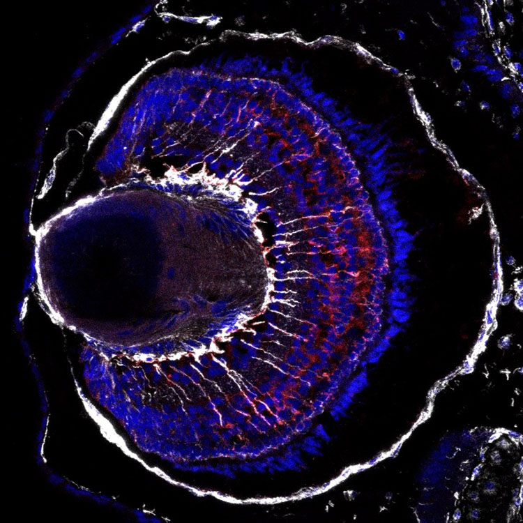Immunohistochemistry fluorescent image of a frog (xenopus laevis) eye showing reactive Muller Glia (white) in the injured retina