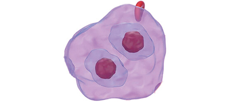 Lymphoma Cell