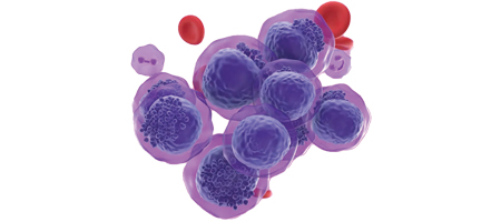 Leukemia Cells