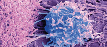 Prostate cancer cell