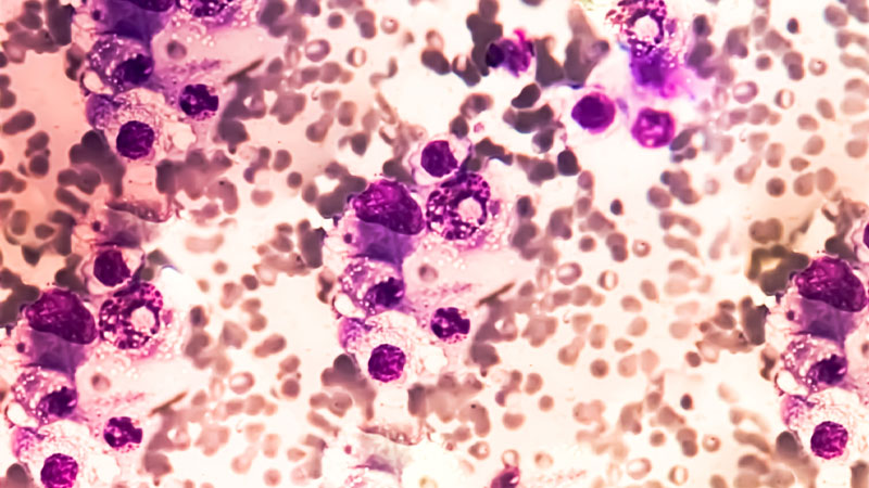 Antibody Therapy Multiple Myeloma