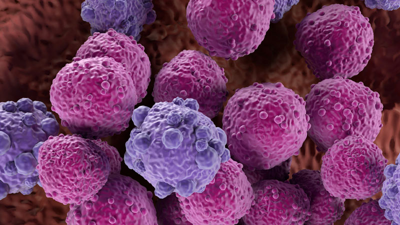 Less Toxic Lymphoma Treatment