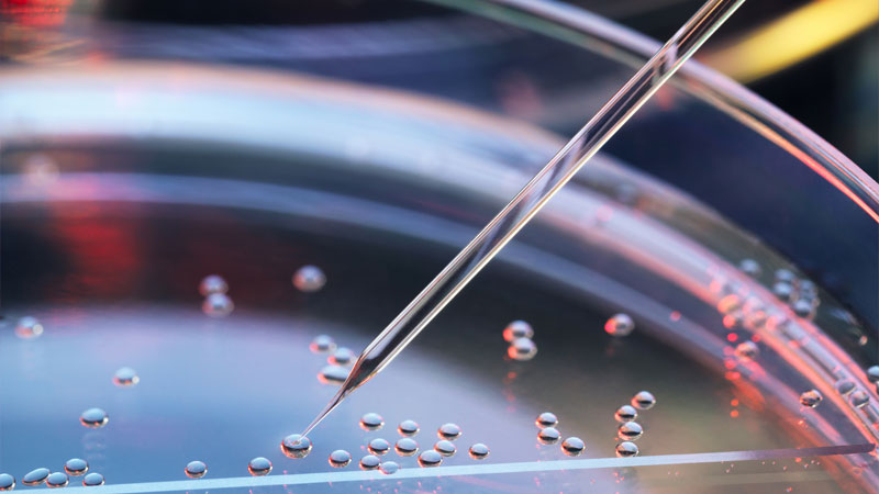 Stem Cell Transplant Matches