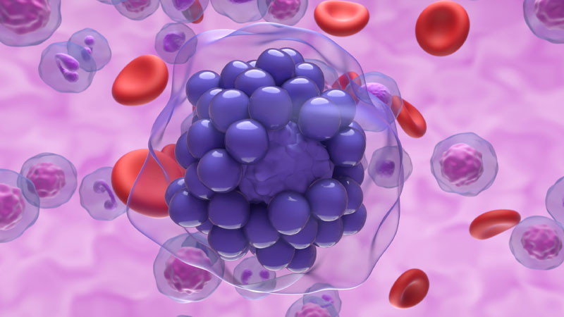 Stacked Approaches Lymphoma