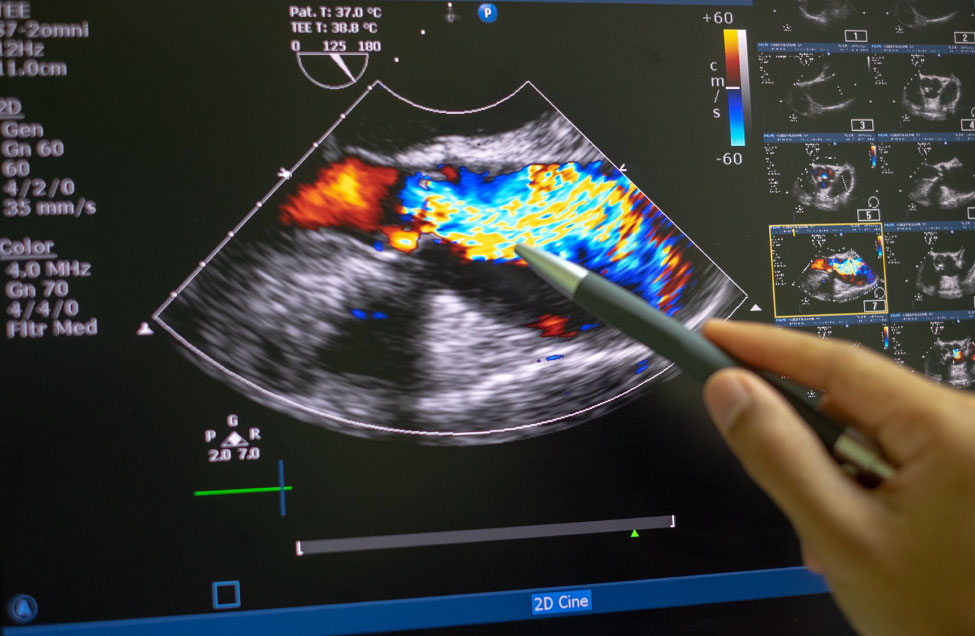 ultrasound probe on a chest