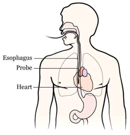 ultrasound probe on a chest