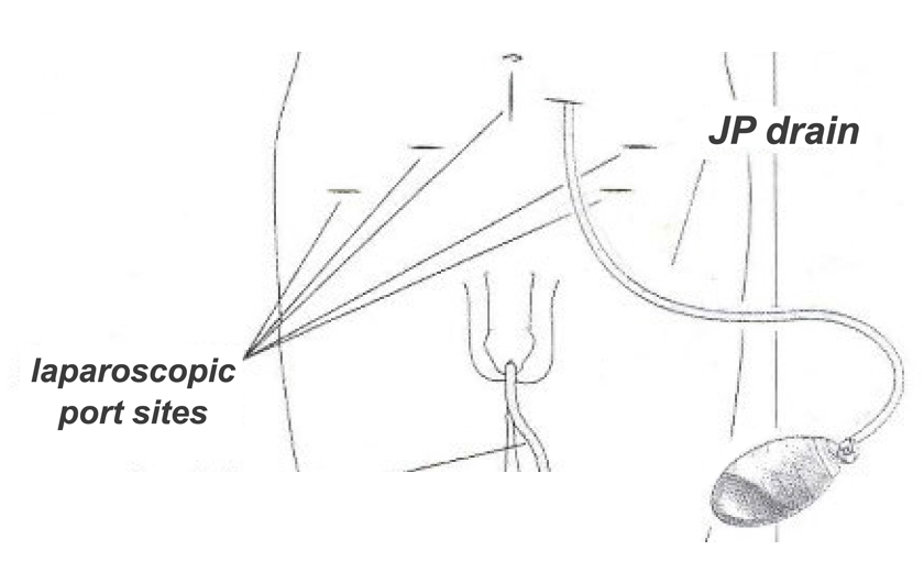 Incision care image