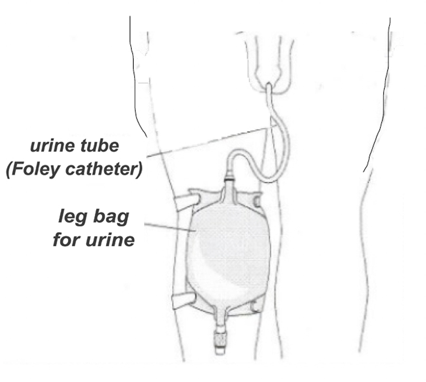 Catheter care image