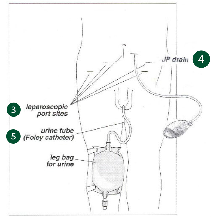 Placeholder for post-surgery care image