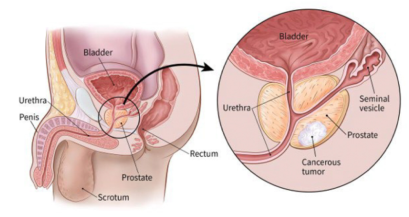 Placeholder for prostate anatomy image