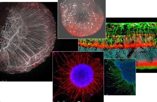 Orbital Vision Research