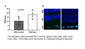 Investigating the contribution of diet and environmental factors to ocular disease