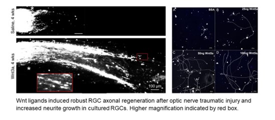 Identification of optic nerve regeneration factors