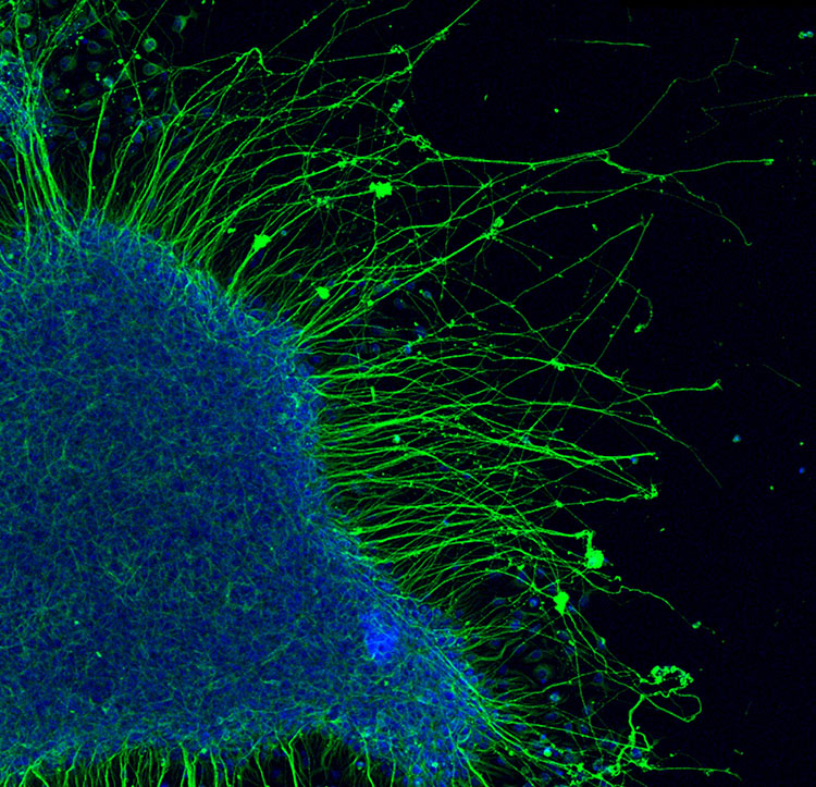 Neurosphere made from human iPSC-derived retinal ganglion cells (RGC) isolated from our retinal organoid platform