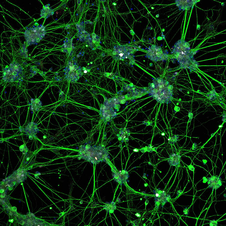 Immunohistochemistry fluorescent image of mouse retinal ganglion cells following modulation of repulsive axonal guidance cues in-vitro