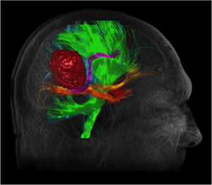 Brain image 300px