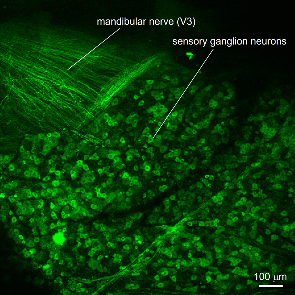 Trigeminal  ganglion  (somatosensory) as viewed during in  vivo Ca2+ imaging.