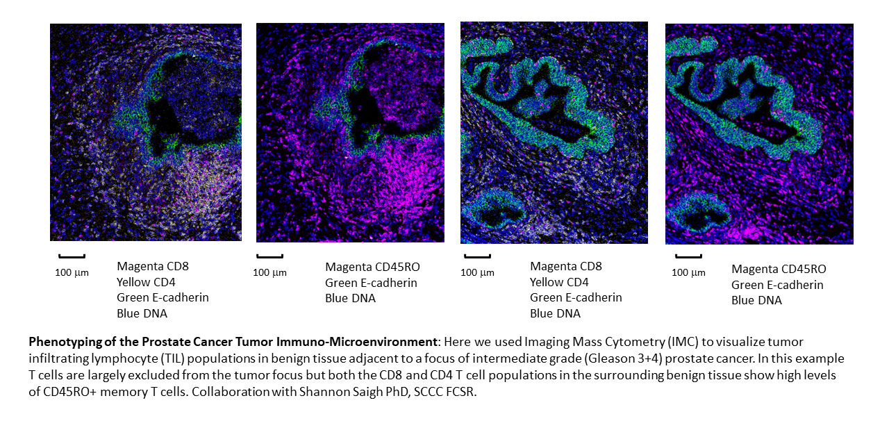 Phenotyping of the Prostate Cancer Tumor Immuno-Microenvironment: