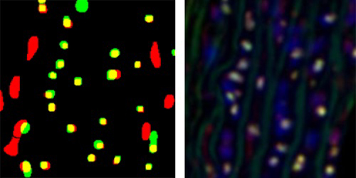 Example: Nerve termini automated quantification Dr McCabe lab
