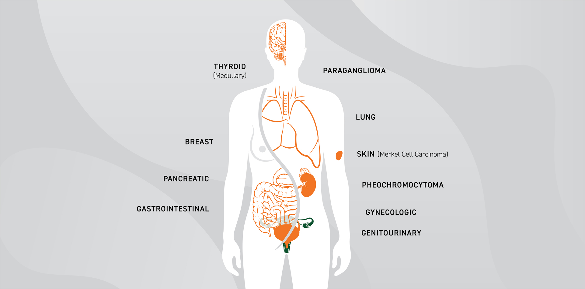 Diagram showing the various parts in the body where NET tumors are sometimes found
