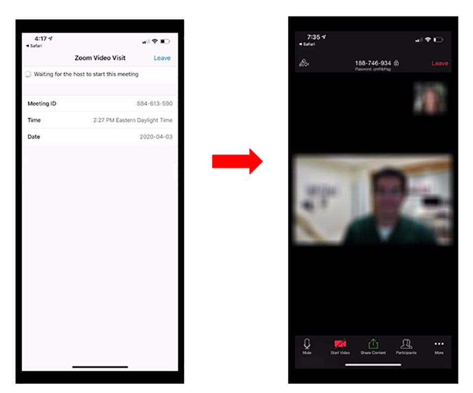 Zoom video settings