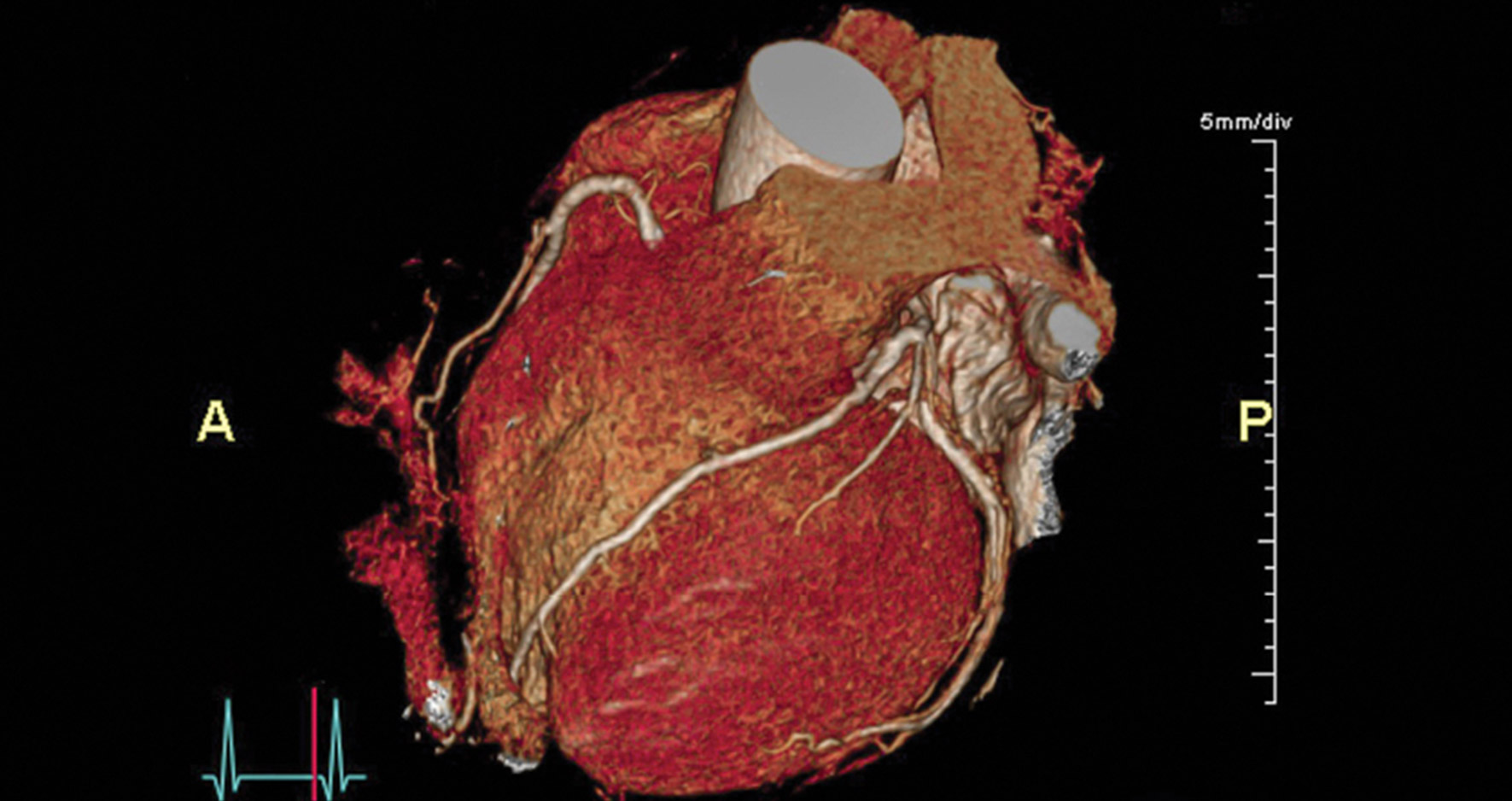 Heart Imaging